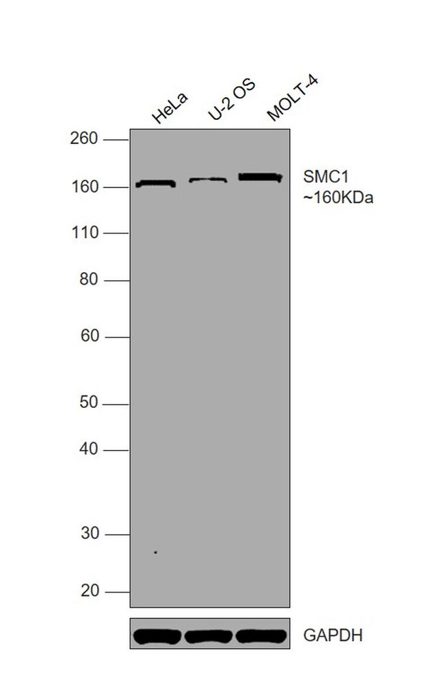 SMC1 Antibody in Western Blot (WB)