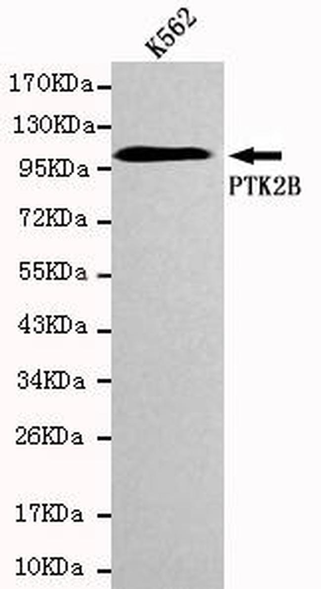 PYK2 Antibody in Western Blot (WB)