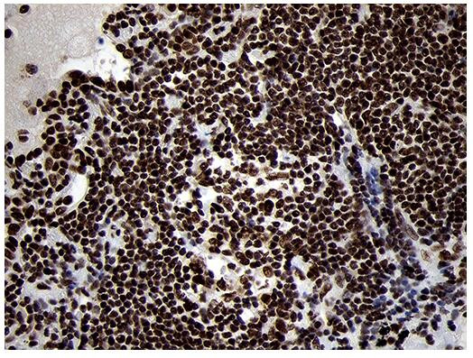 SMC1 Antibody in Immunohistochemistry (Paraffin) (IHC (P))