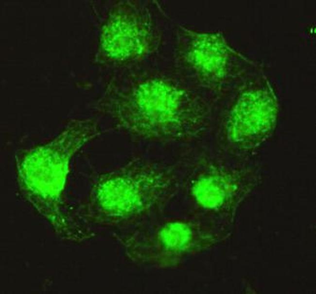 PPP4C Antibody in Immunocytochemistry (ICC/IF)