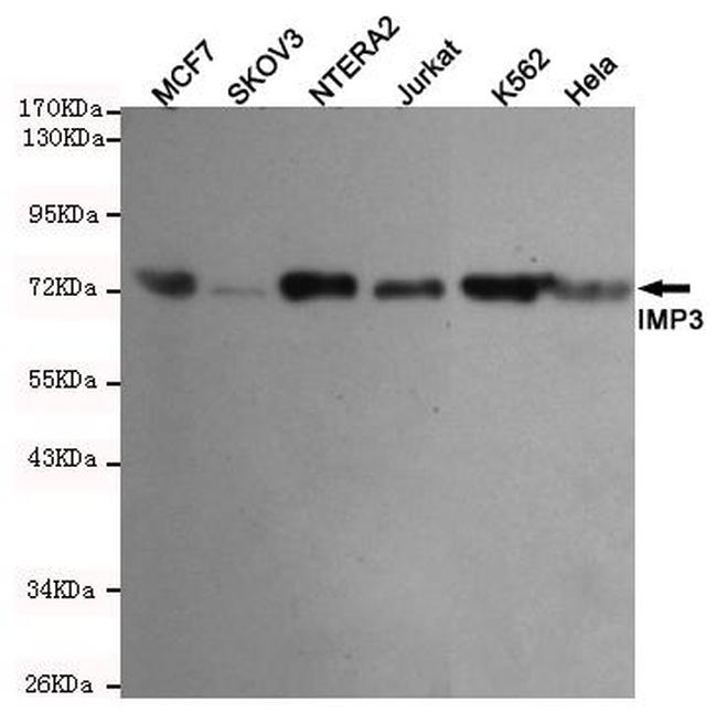 IGF2BP3 Antibody in Western Blot (WB)