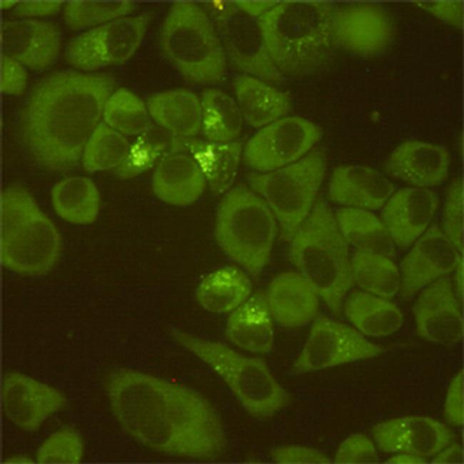 DDX3 Antibody in Immunocytochemistry (ICC/IF)