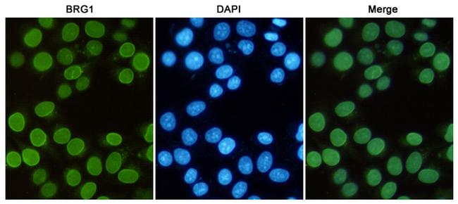 BRG1 Antibody in Immunocytochemistry (ICC/IF)