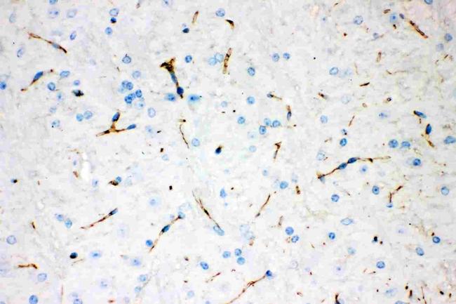 Tyrosine Hydroxylase Antibody in Immunohistochemistry (Paraffin) (IHC (P))