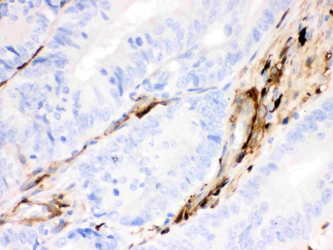 Gelsolin Antibody in Immunohistochemistry (Paraffin) (IHC (P))