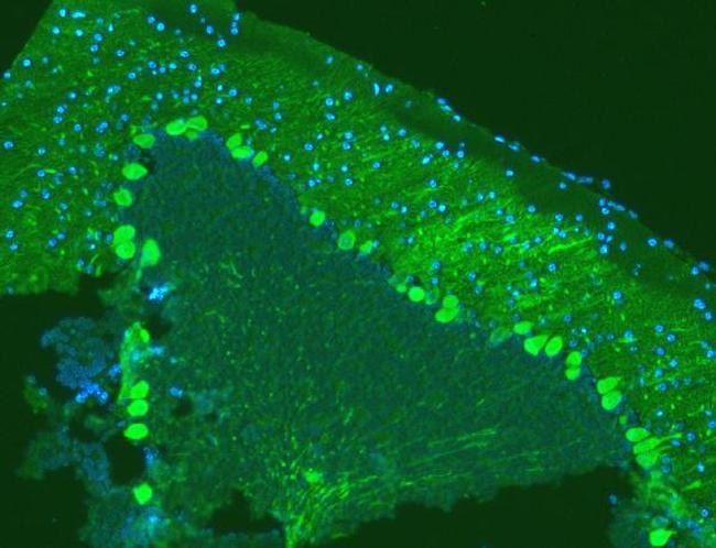 Calbindin D28K Antibody in Immunohistochemistry (Paraffin) (IHC (P))