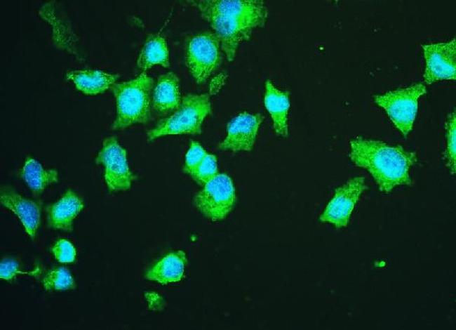 HSPA2 Antibody in Immunocytochemistry (ICC/IF)