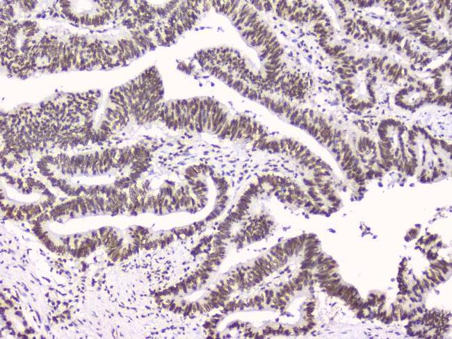 RbAp48 Antibody in Immunohistochemistry (Paraffin) (IHC (P))