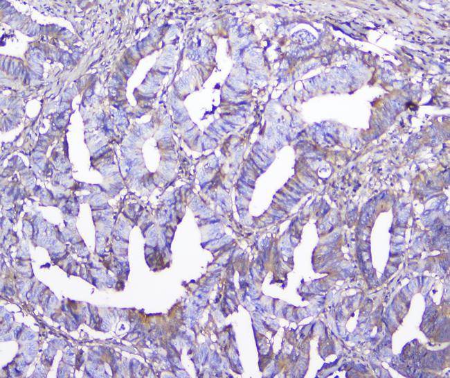 GSTM1 Antibody in Immunohistochemistry (Paraffin) (IHC (P))