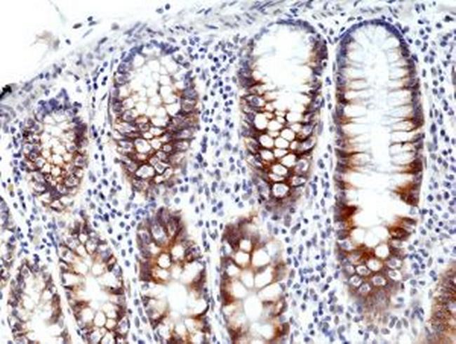 CD71 (Transferrin Receptor) Antibody in Immunohistochemistry (Paraffin) (IHC (P))