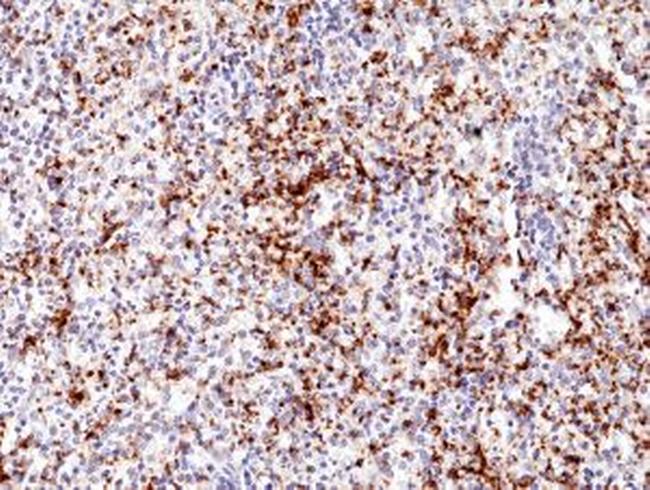 CD61 (Integrin beta 3) Antibody in Immunohistochemistry (Paraffin) (IHC (P))