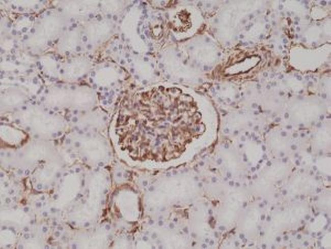 Vimentin Antibody in Immunohistochemistry (Paraffin) (IHC (P))