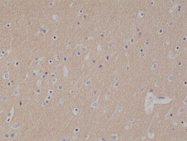 CD56 (NCAM) Antibody in Immunohistochemistry (Paraffin) (IHC (P))