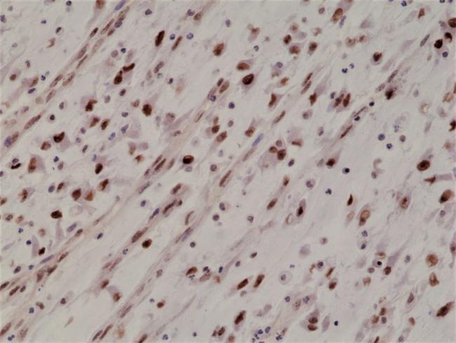 MYOD Antibody in Immunohistochemistry (Paraffin) (IHC (P))