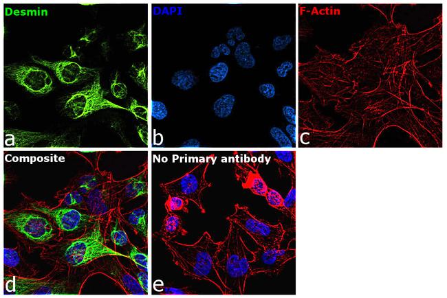 Desmin Antibody in Immunocytochemistry (ICC/IF)