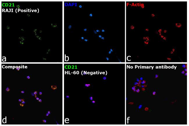 CD21 Antibody in Immunocytochemistry (ICC/IF)