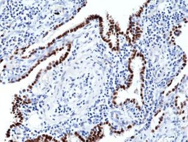 Nkx2.1 Antibody in Immunohistochemistry (Paraffin) (IHC (P))