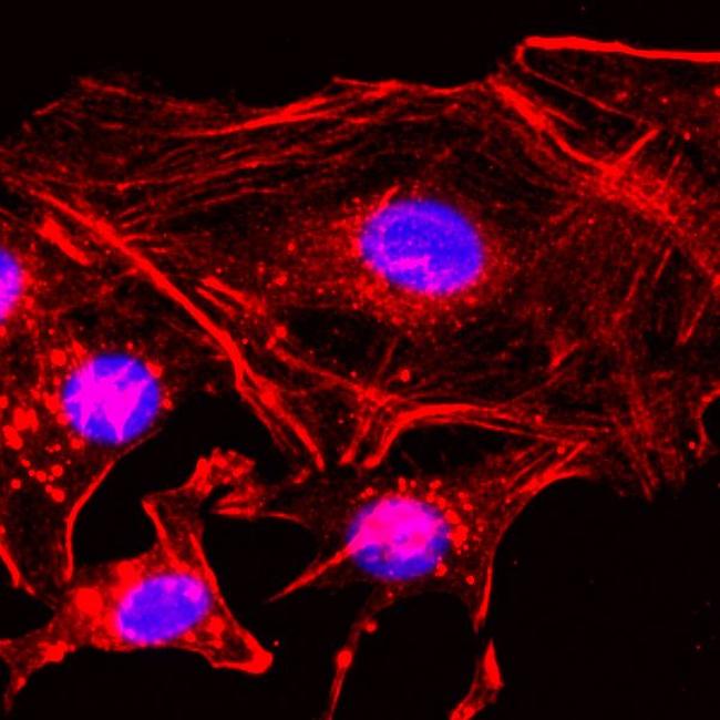 beta Actin Antibody in Immunocytochemistry (ICC/IF)