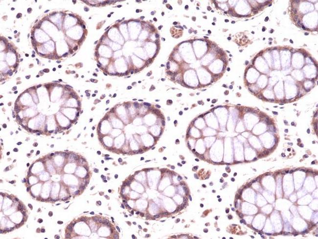 AMPK alpha-1 Antibody in Immunohistochemistry (Paraffin) (IHC (P))