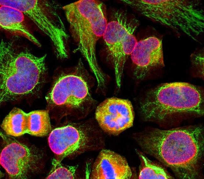 Nuclear Pore Complex Antibody in Immunocytochemistry (ICC/IF)