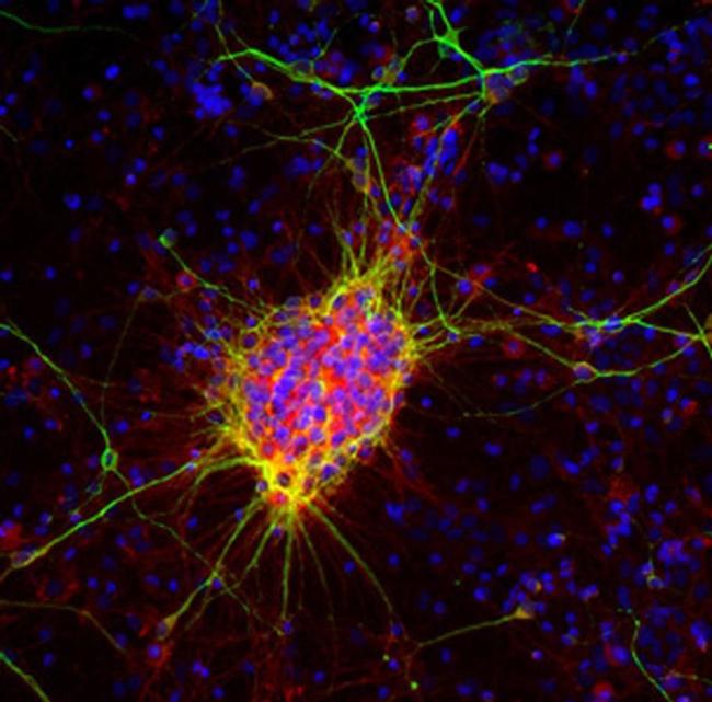 Doublecortin Antibody in Immunocytochemistry (ICC/IF)