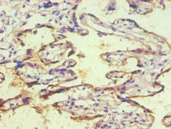 CD59 Antibody in Immunohistochemistry (Paraffin) (IHC (P))