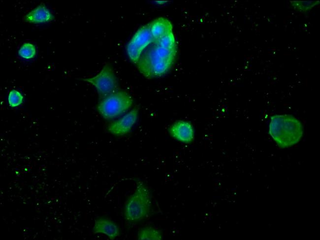 Myoglobin Antibody in Immunocytochemistry (ICC/IF)