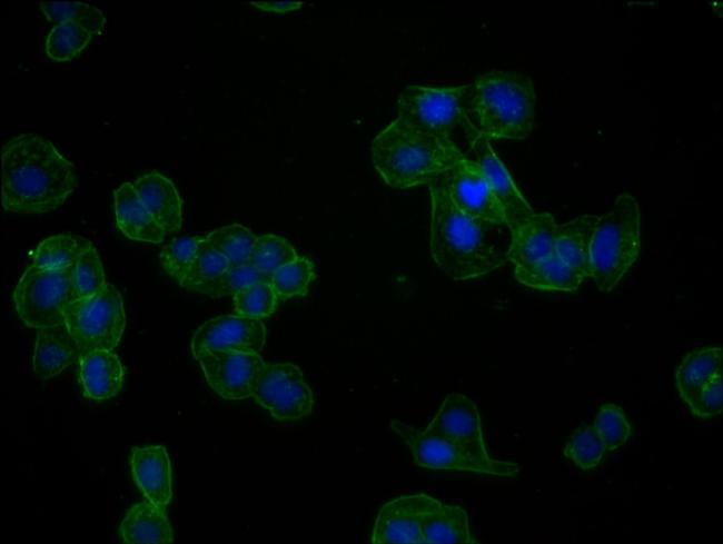 Actin Antibody in Immunocytochemistry (ICC/IF)