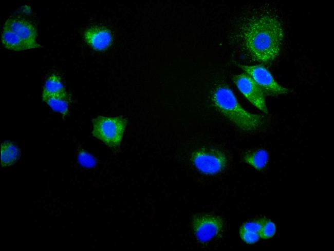 CD9 Antibody in Immunocytochemistry (ICC/IF)