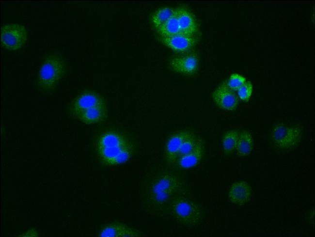 Aromatase Antibody in Immunocytochemistry (ICC/IF)