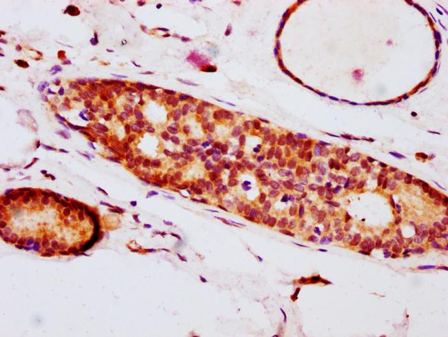 Phospho-eIF4E (Ser209) Antibody in Immunohistochemistry (Paraffin) (IHC (P))