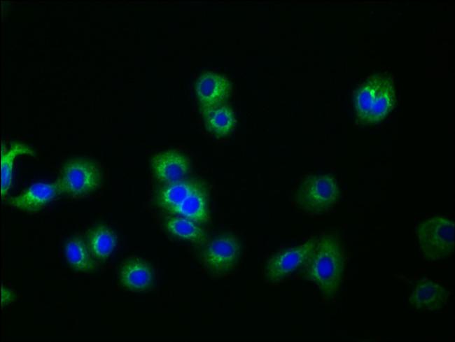 Glypican 3 Antibody in Immunocytochemistry (ICC/IF)