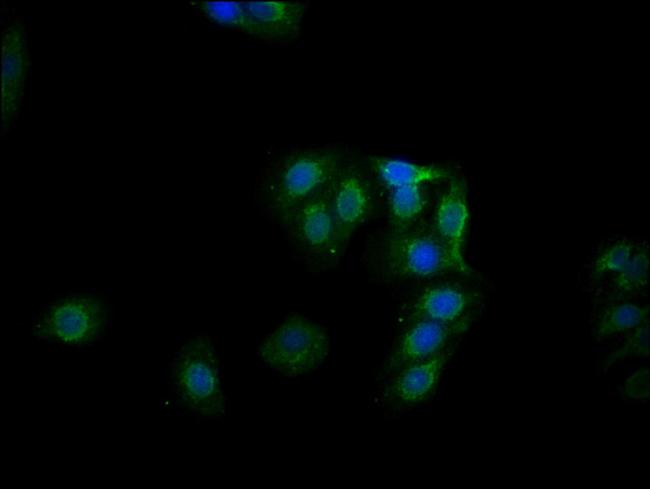 Phospho-GYS1 (Ser641) Antibody in Immunocytochemistry (ICC/IF)