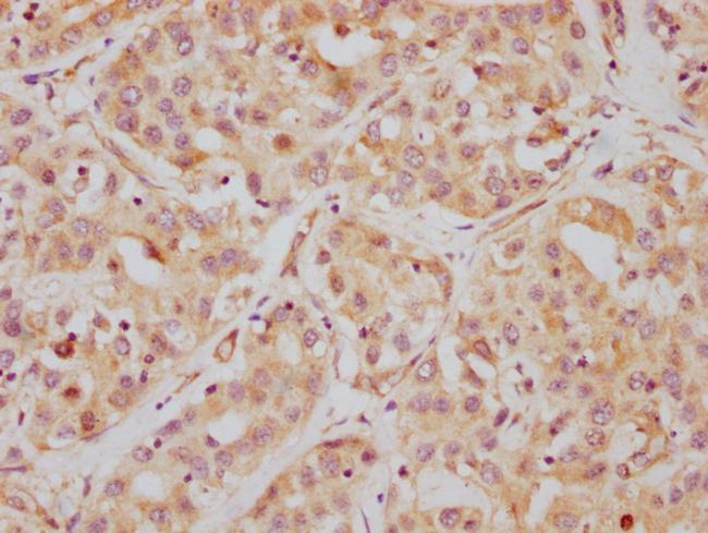 HDAC6 Antibody in Immunohistochemistry (Paraffin) (IHC (P))