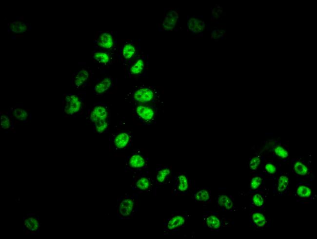 HDAC9 Antibody in Immunocytochemistry (ICC/IF)