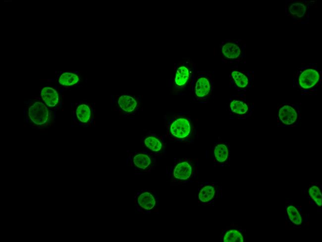 hnRNP K Antibody in Immunocytochemistry (ICC/IF)