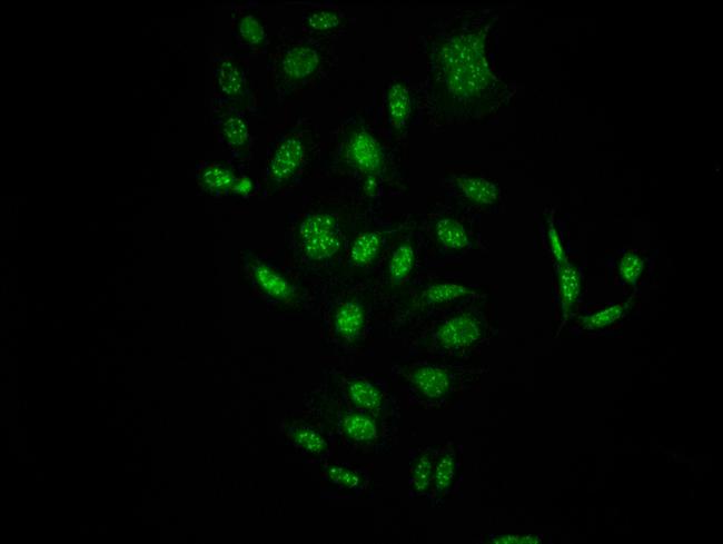 Phospho-c-Raf (Ser621) Antibody in Immunocytochemistry (ICC/IF)