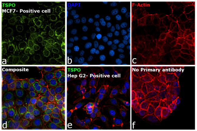 TSPO Antibody in Immunocytochemistry (ICC/IF)