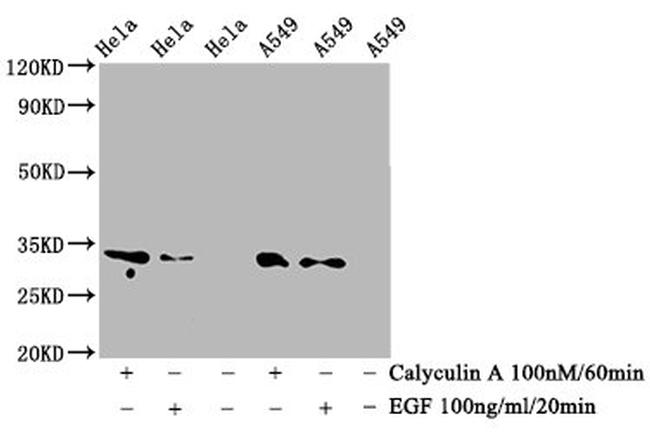 Phospho-CDK1/CDK2/CDK3 (Thr14) Antibody in Western Blot (WB)