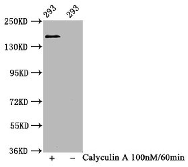 Phospho-SMC1 (Ser957) Antibody in Western Blot (WB)