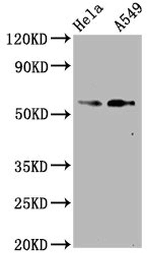 Phospho-SMAD2 (Ser250) Antibody in Western Blot (WB)