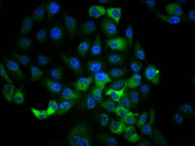 Phospho-RSK1 (Thr359, Ser363) Antibody in Immunocytochemistry (ICC/IF)