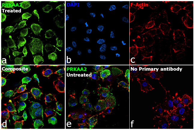 Phospho-AMPK alpha-2 (Thr172) Antibody in Immunocytochemistry (ICC/IF)