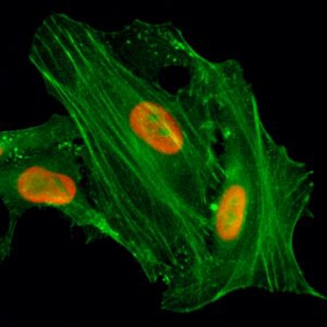 H4K8ac Antibody in Immunocytochemistry (ICC/IF)