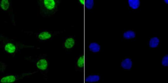 RbAp48 Antibody in Immunocytochemistry (ICC/IF)