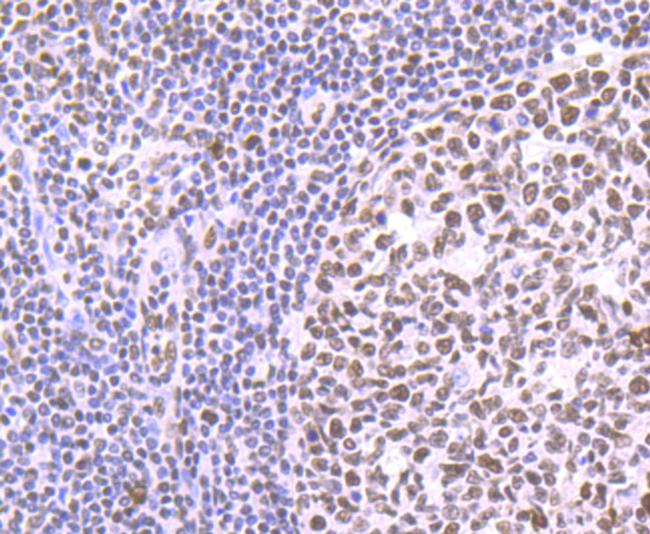 PTBP1 Antibody in Immunohistochemistry (Paraffin) (IHC (P))