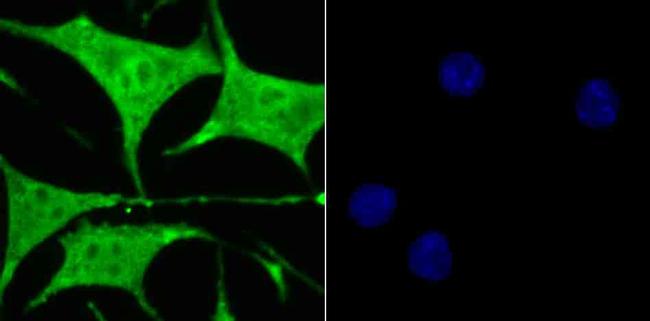 GLO1 Antibody in Immunocytochemistry (ICC/IF)