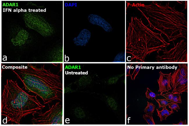 ADAR1 Antibody in Immunocytochemistry (ICC/IF)