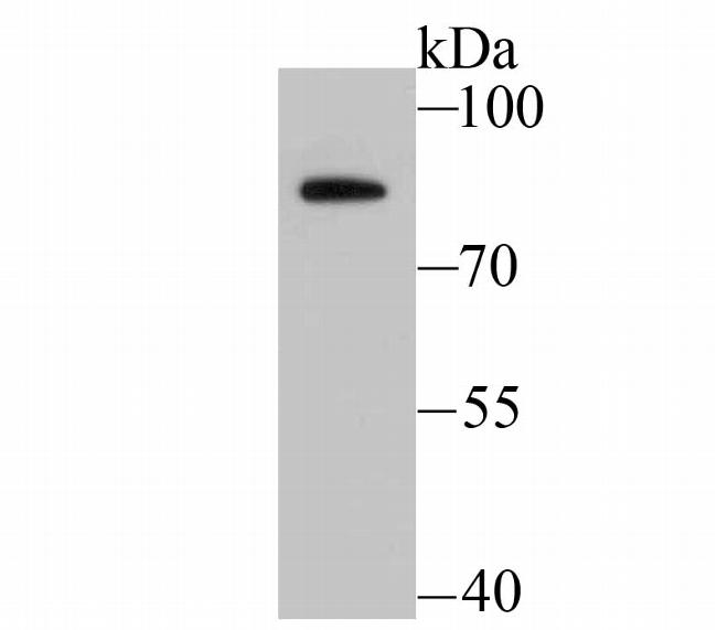 BDKRB2 Antibody in Western Blot (WB)