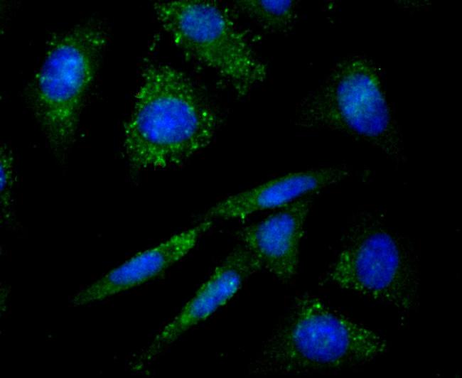 PRKD2 Antibody in Immunocytochemistry (ICC/IF)